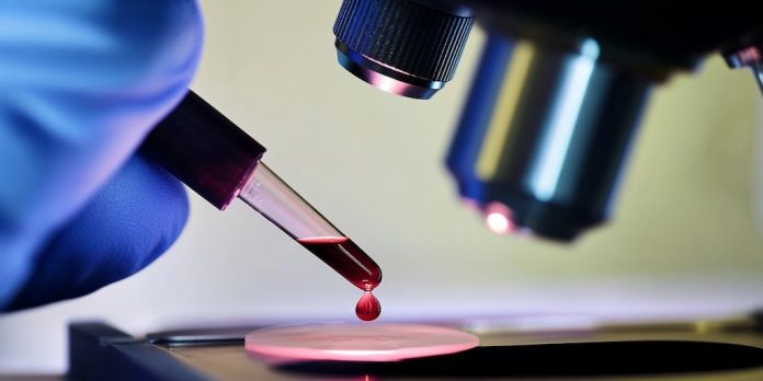 Cientos de frascos con virus mortales desaparecieron de un laboratorio en Australia